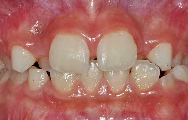 248884_01.jpg (680.6 KiB) 9748 mal betrachtet Frontansicht, geschlossen