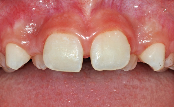 248884_02.jpg (666.83 KiB) 9748 mal betrachtet Frontansicht, nur Oberkiefer