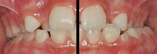 248884_05.jpg (1.12 MiB) 9748 mal betrachtet Ansicht der seitlichen Zahnbogen