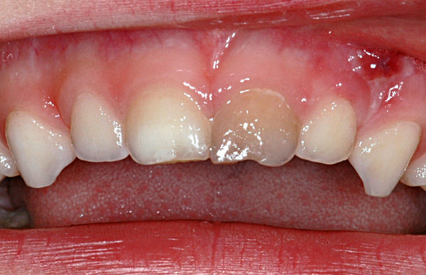 340011_1.jpg (939.3 KiB) 26822 mal betrachtet Drei Monate nach dem Unfall