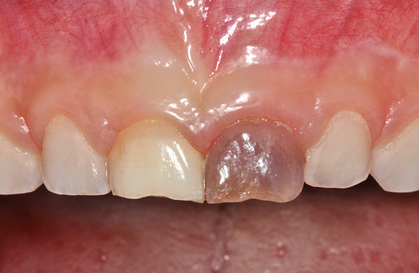 340011_4.jpg (745.76 KiB) 29835 mal betrachtet Ein Jahr nach dem Unfall