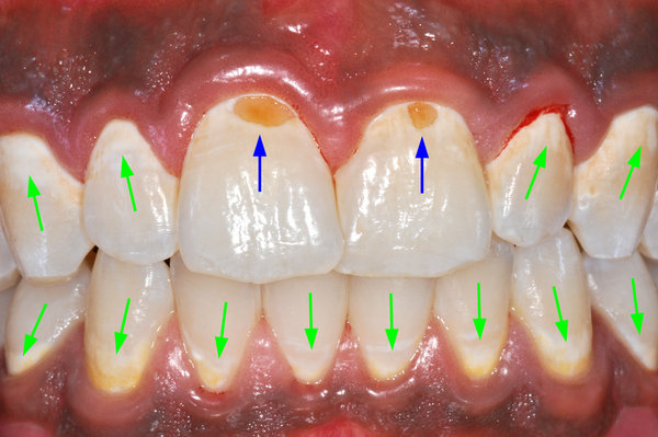 173787_01_text.jpg (757.54 KiB) 26606 mal betrachtet Frontansicht mit Bezeichnungen