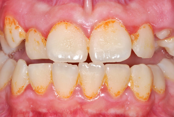 269839_01.jpg (709.93 KiB) 25779 mal betrachtet orange stain