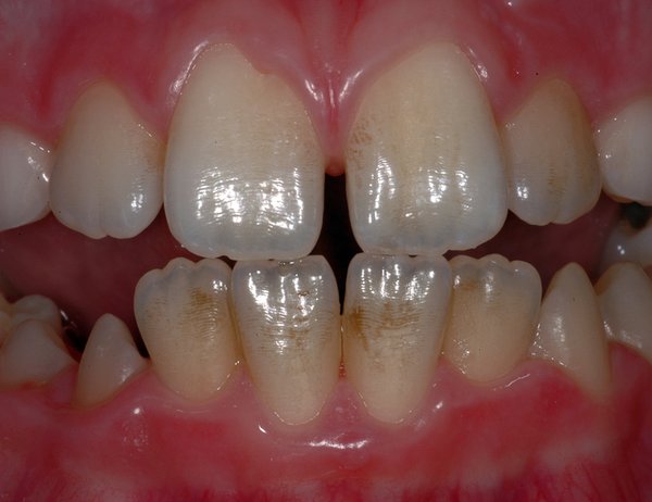 227525_04.jpg (347.47 KiB) 30153 mal betrachtet Verfärbungen und Delle I