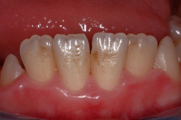 227525_01.jpg (290.5 KiB) 30153 mal betrachtet Verfärbungen und Delle II