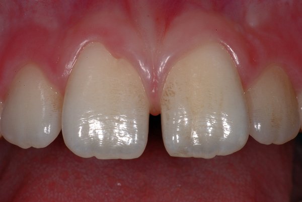 227525_03.jpg (281.83 KiB) 30184 mal betrachtet Verfärbungen und Delle III