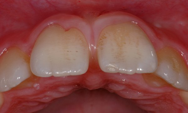 227525_02.jpg (268.92 KiB) 30184 mal betrachtet Verfärbungen und Delle IV